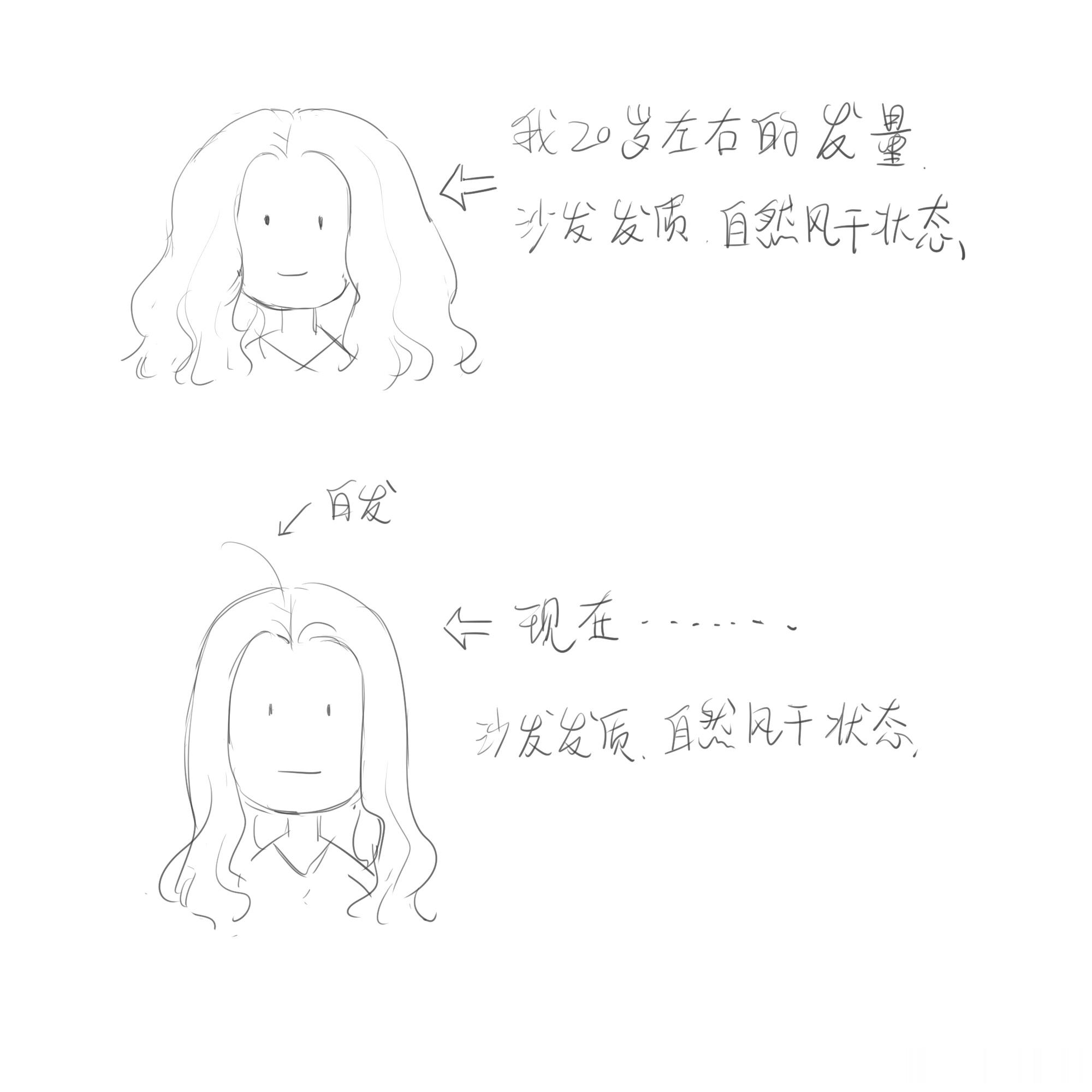 我的发量 