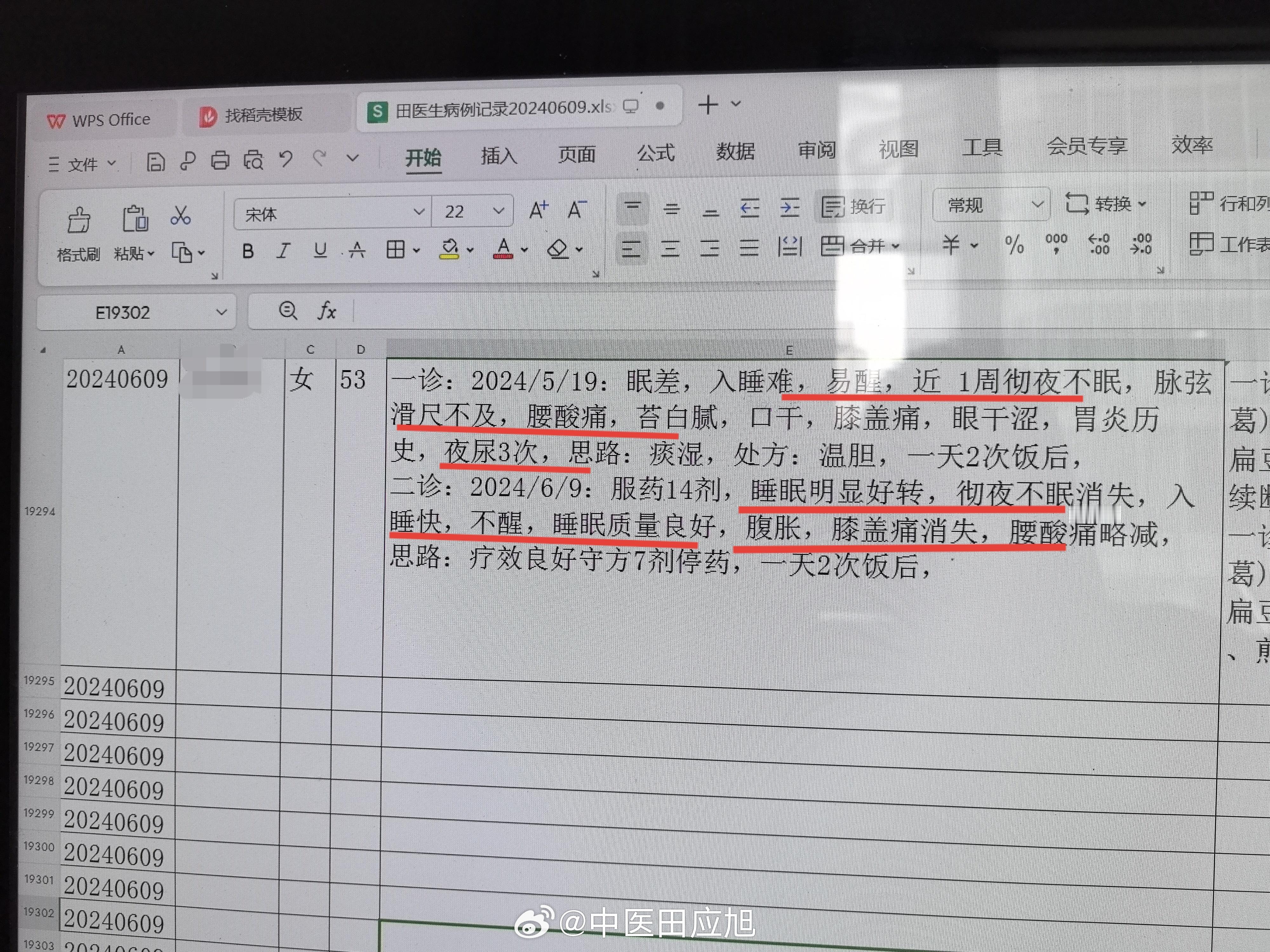 #中医##失眠#   53岁阿姨，长期失眠，入睡困难，就诊时严重失眠，整整一周每