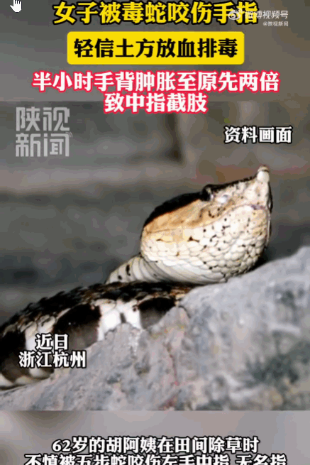 土方治大病，糊涂要人命！浙江宁波，一62岁阿姨在田间除草时，左手不慎被剧毒五步蛇