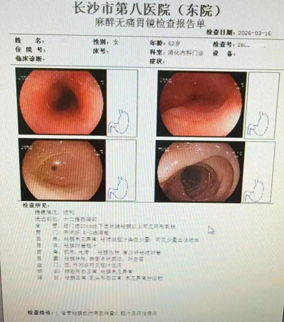 “人怎么能饿成这样？”江苏，一名女子因为饿坏了，出门去饭，又着急想吃饱，居然直接