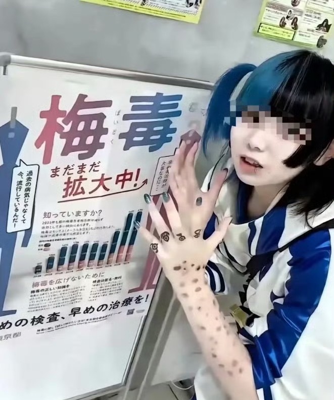 日本梅毒扩散梅毒真实图片太恐怖，不发了。看下“梅毒妆”吧。 