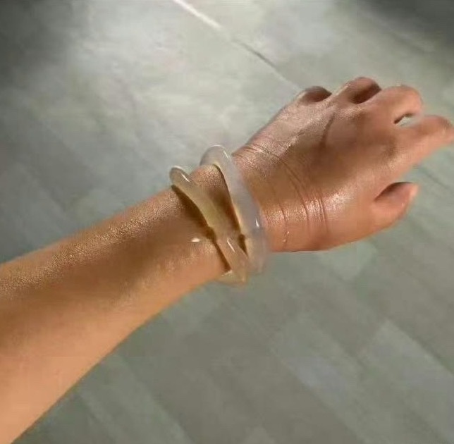 老婆的手镯取不下来了，该怎么办才好？ ​​​