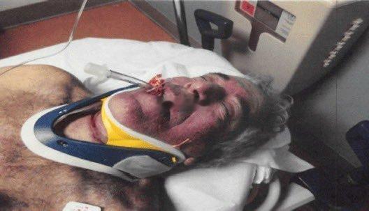 怎么会自杀呢？上吊的话，绳子不是套在下巴里面一点吗，怎么跑下面去了？不符合物理学