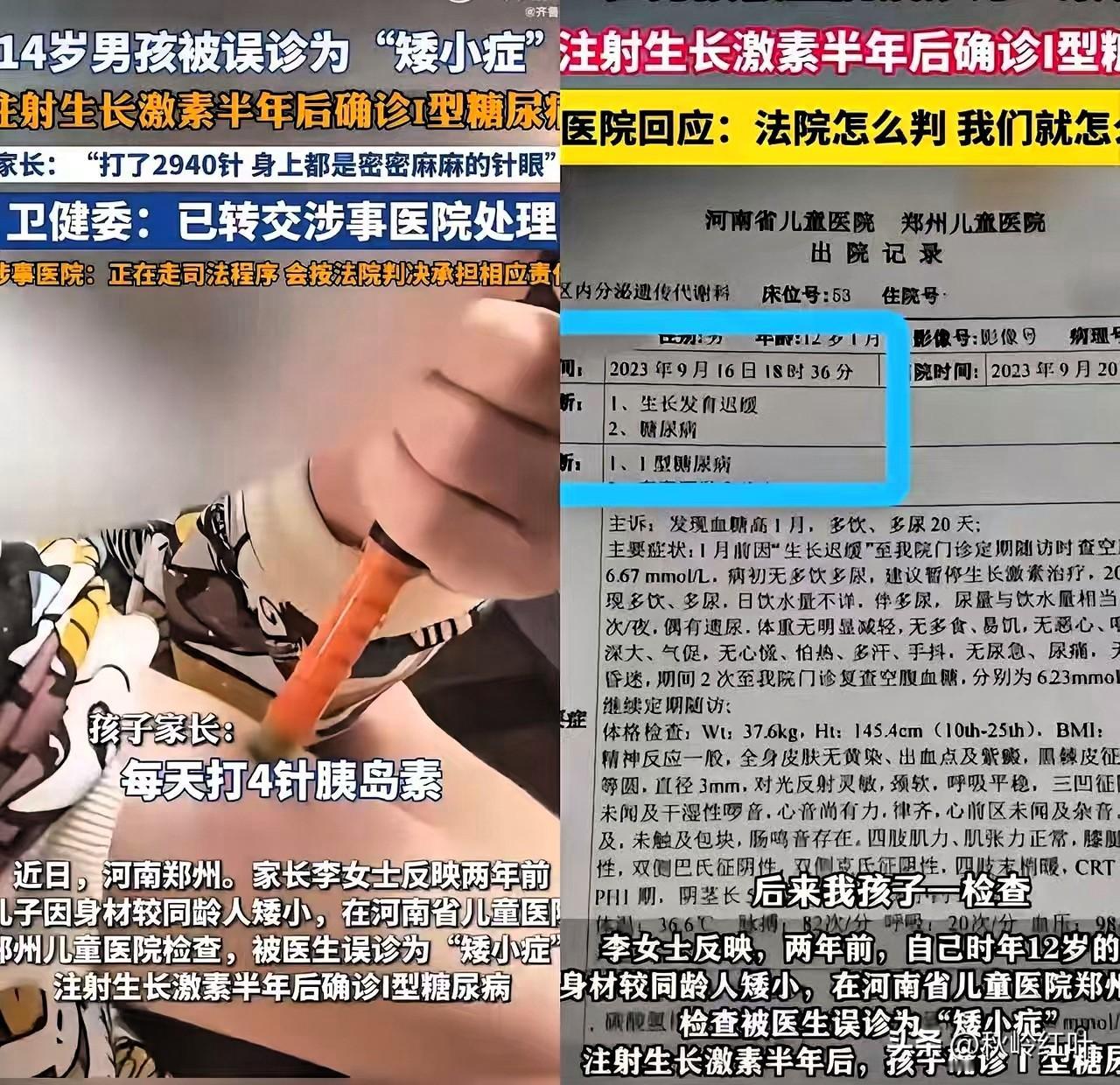 全网最惨的应该是河南这个小男孩了
打了大半年的生长激素

没让14岁男孩长高，反