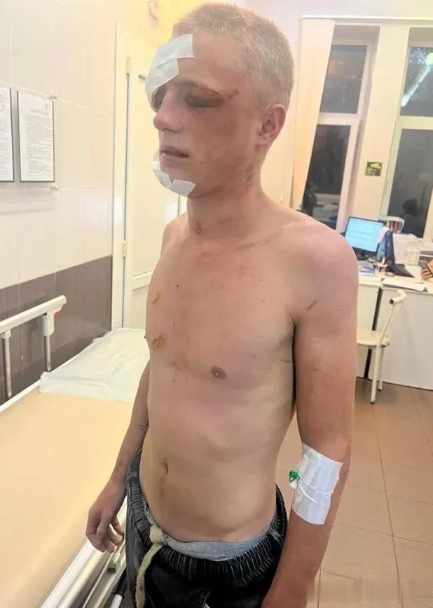 没在乌军枪炮下“去军事化”，而在强盗拳头下去世。在俄罗斯的克拉斯诺达尔边疆区发生