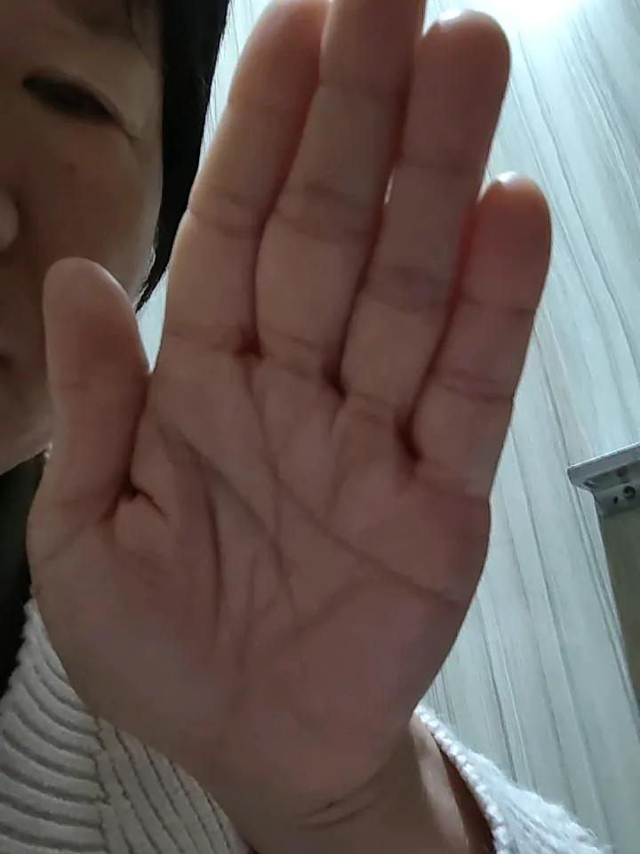 万能的网友，看看我这手指有啥毛病没有，张雪峰去世了，可把我吓坏了，火眼金睛的网友