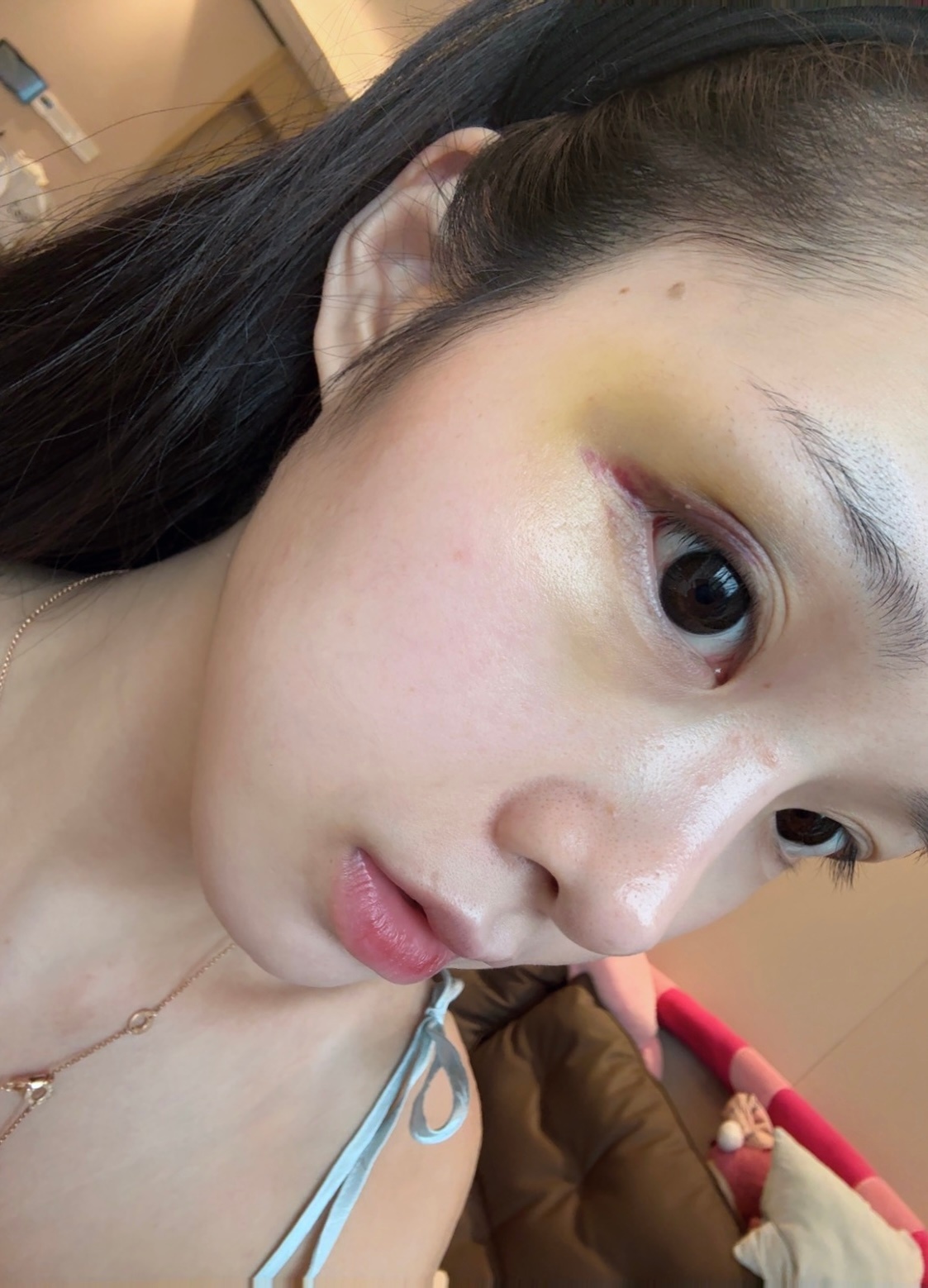 好像给人揍了一样ಥ_ಥ ​​​