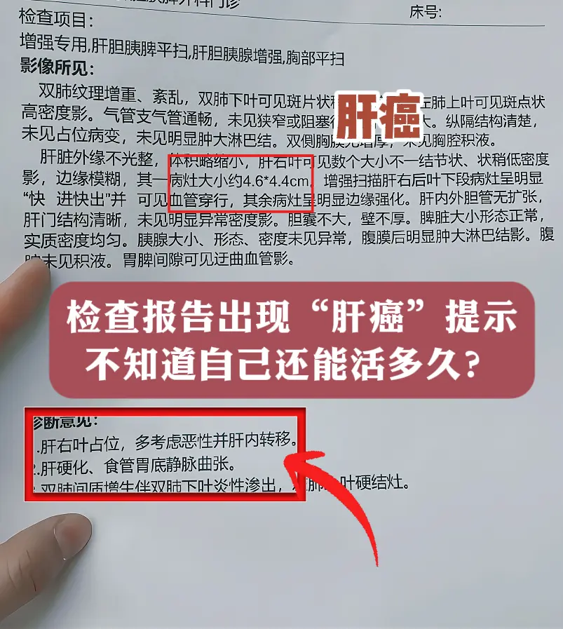 检查报告出现“肝癌”提示，不知道自己还能活多久？ 真没想到，刚退休2年...