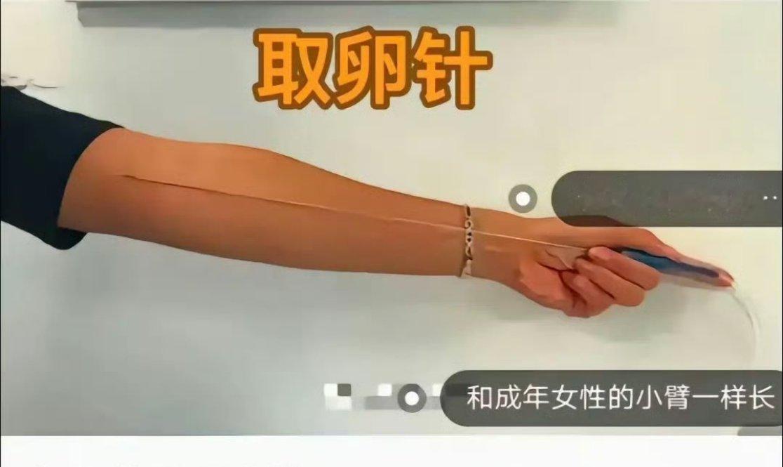 取卵针那么长真的不痛吗能不痛吗？？就算是平时抽血的针也有一点痛感，这个针那么大，