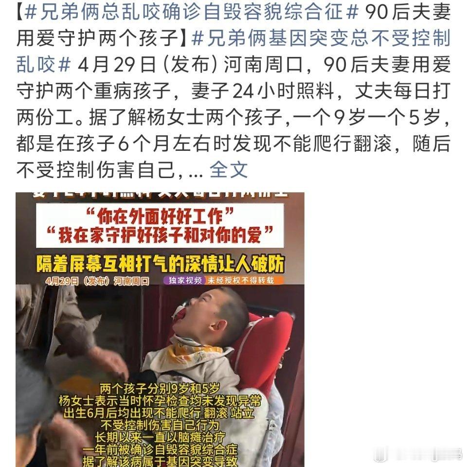 兄弟俩基因突变总不受控制乱咬这是现实版丧尸来袭吗？到处乱咬有点吓人的这对夫妻相互