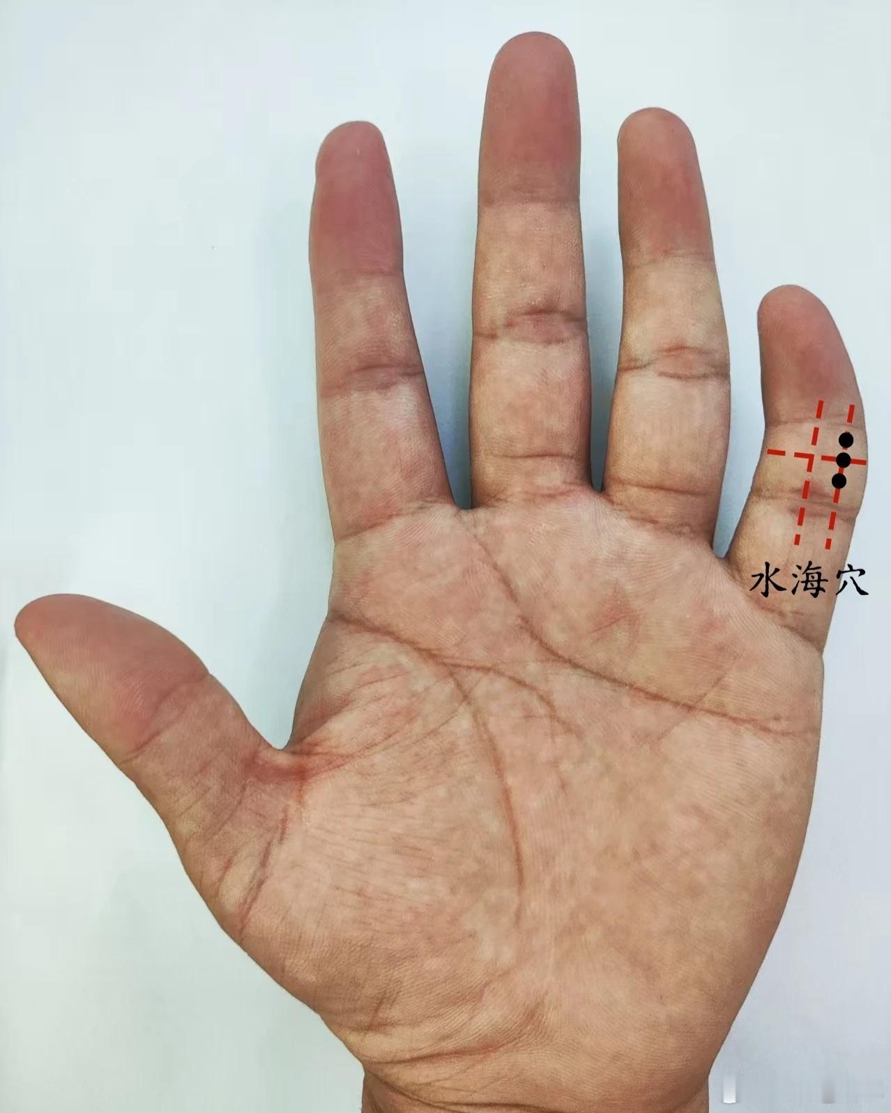 颈背腰痛，水海穴 水海穴源自董氏奇穴位置：在手掌面，小指第二节中央线偏尺侧三分线