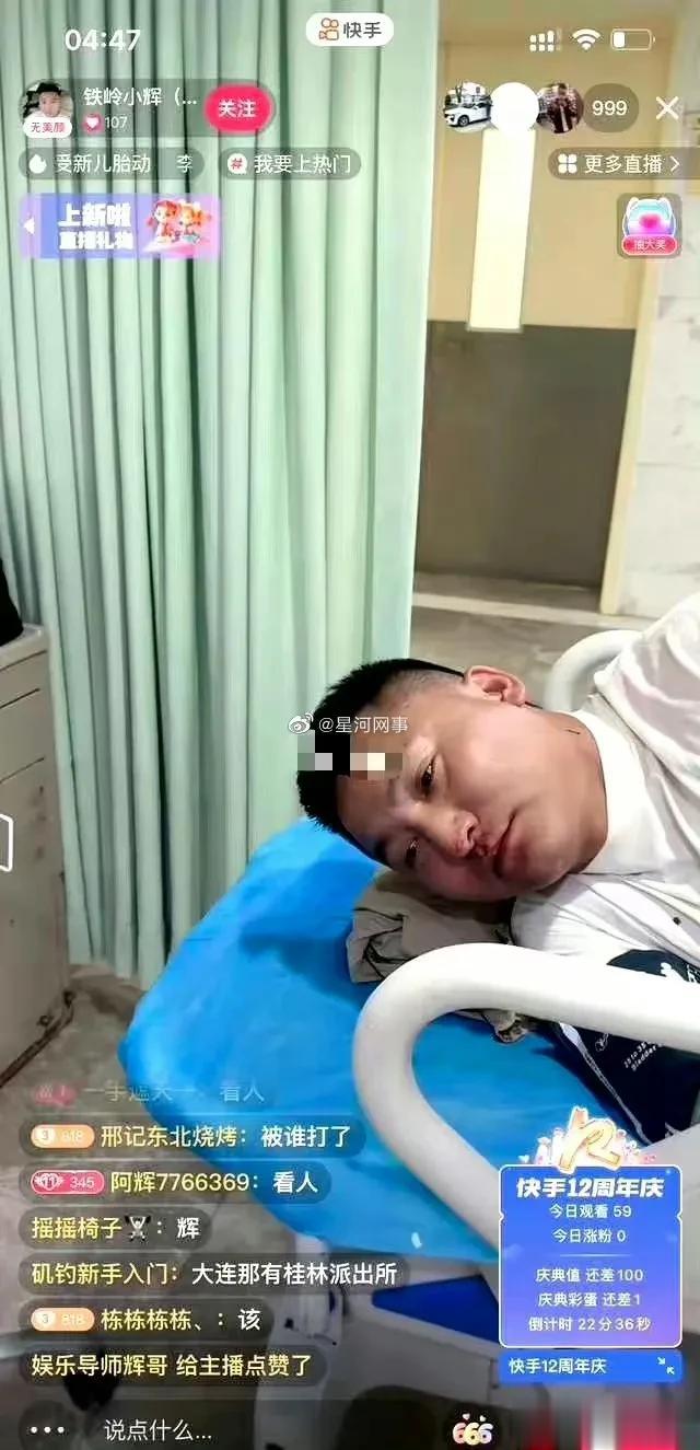 突发！网红铁岭小辉在大连被砍！

6月4日，有网友投稿，网红铁岭小辉在大连被砍伤
