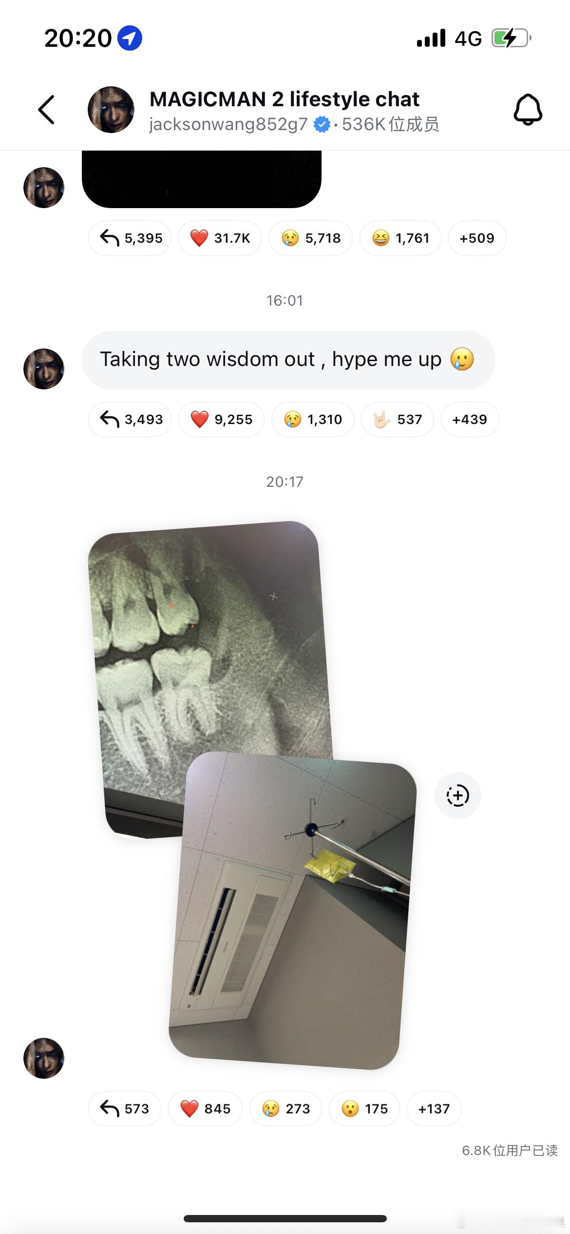 有招了王嘉尔真拔牙了 ​​​