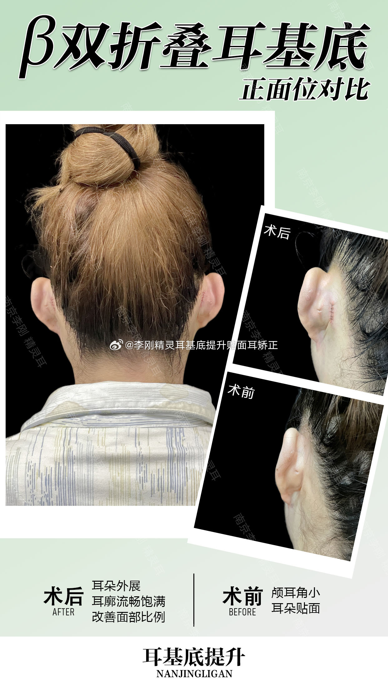 管乐加黄灿灿微信秀美甲