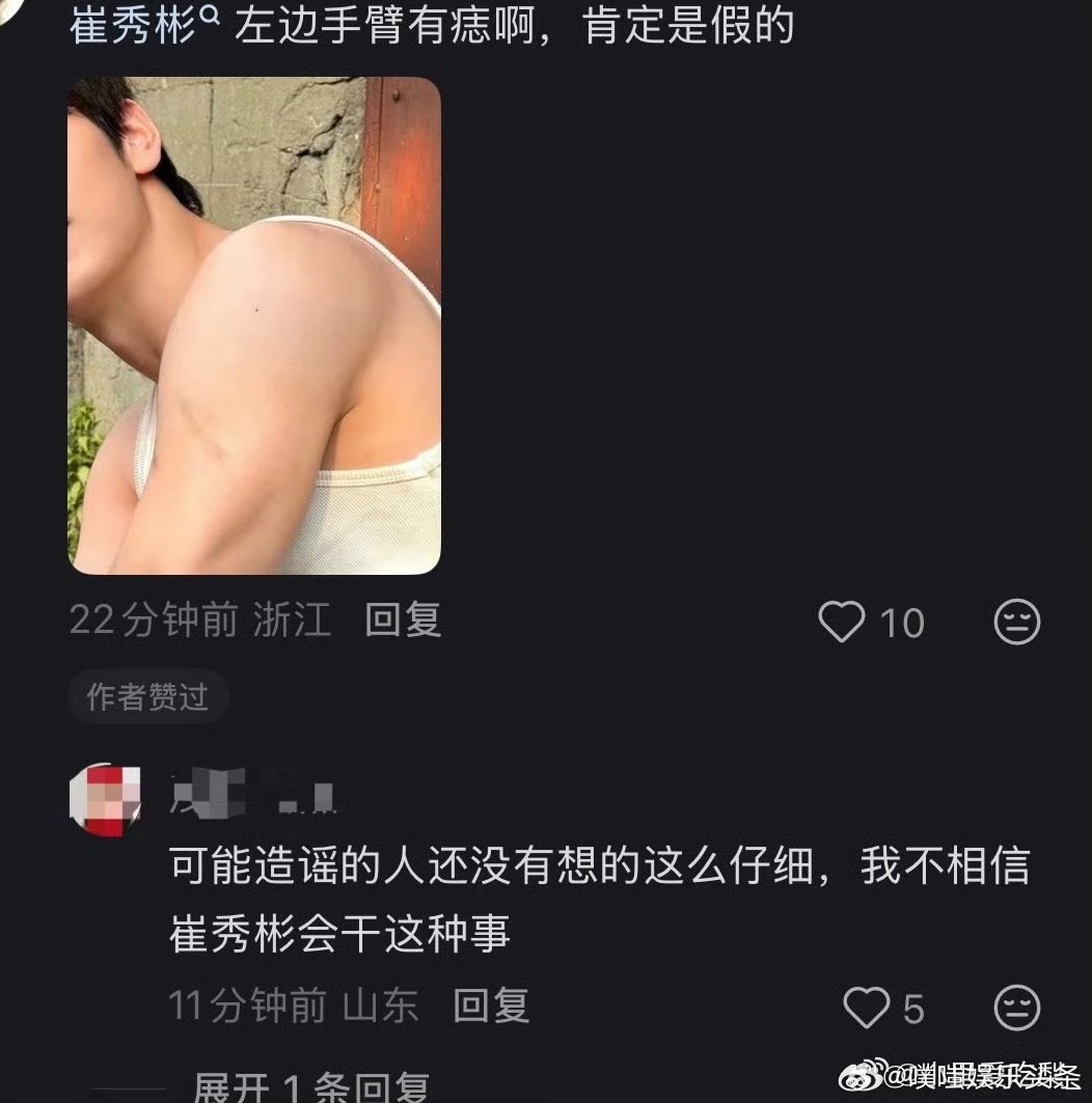 崔秀彬的手臂有痣 崔秀彬 照片冷静看待这场讨论?崔秀彬粉丝澄清手臂外侧有一颗明显