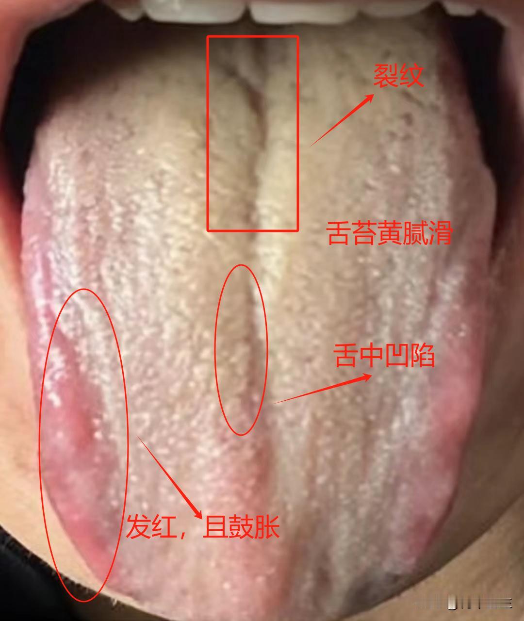 功能不行，能力差劲，这几点中了就赶紧注意一下吧，要不然到最后补都补不回来

这个