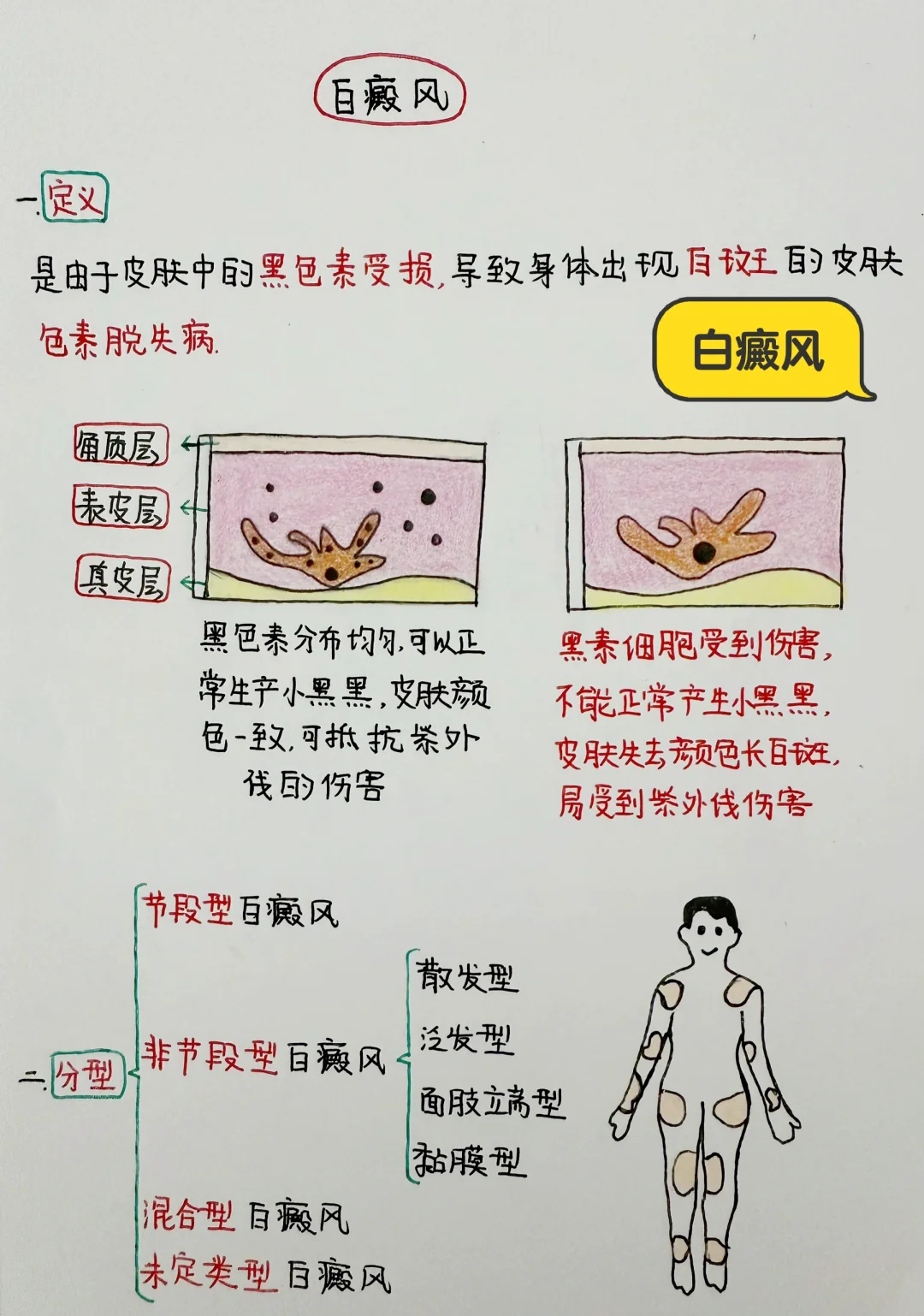 今日学习打卡——白癜风
