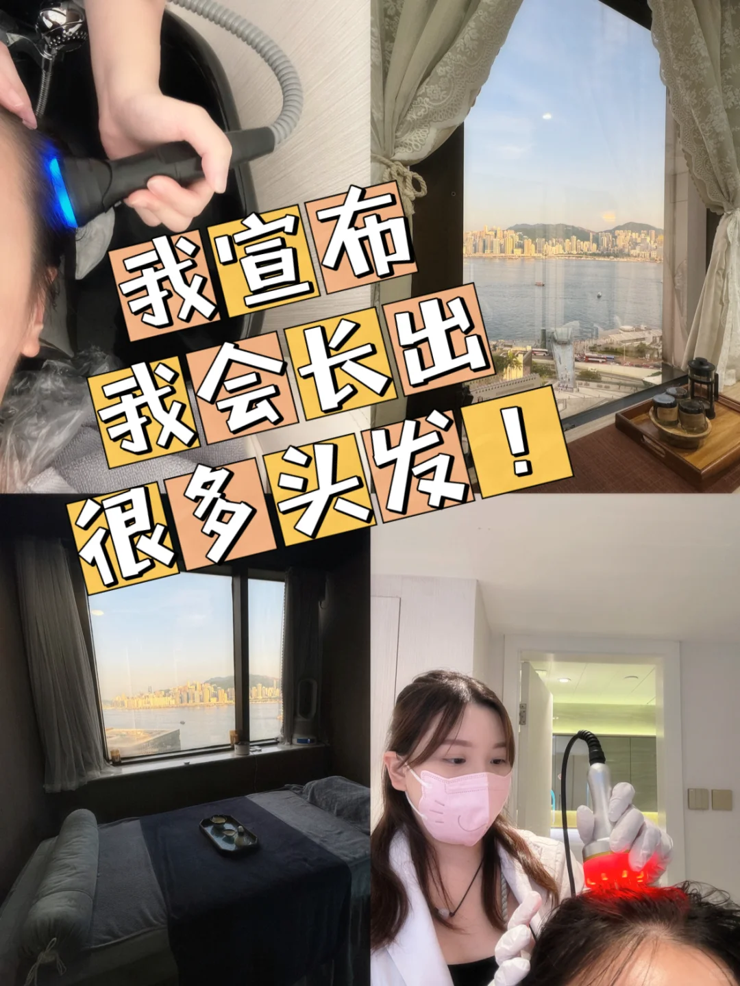 🇭🇰摊牌了！我到了需要生发的年纪🥹㊗️爆长