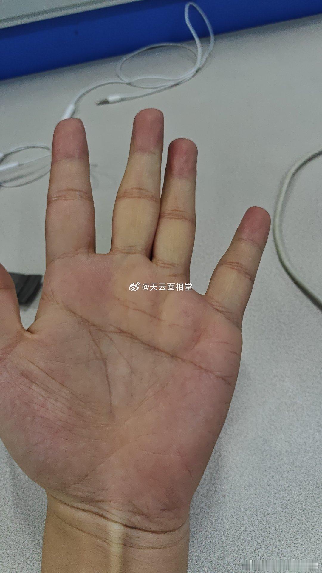 【手相简单点评】朋友较少，学历不高，偏自卑，缺乏毅力，体质也不好，容易疲劳，事业