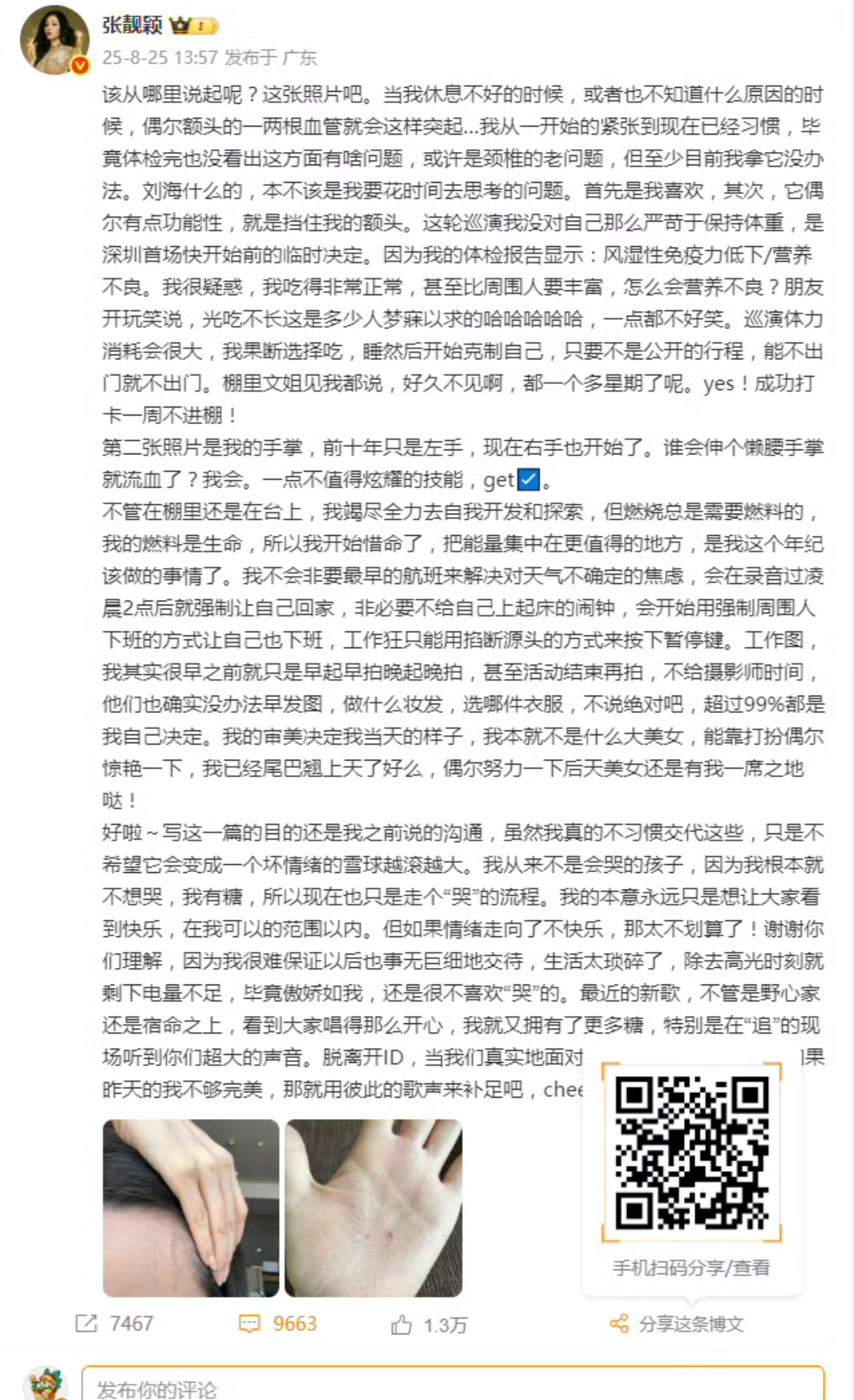 张靓颖风湿性免疫力低下伸个懒腰手掌就流血确实有点可怕了，不管怎样身体才是第一位的