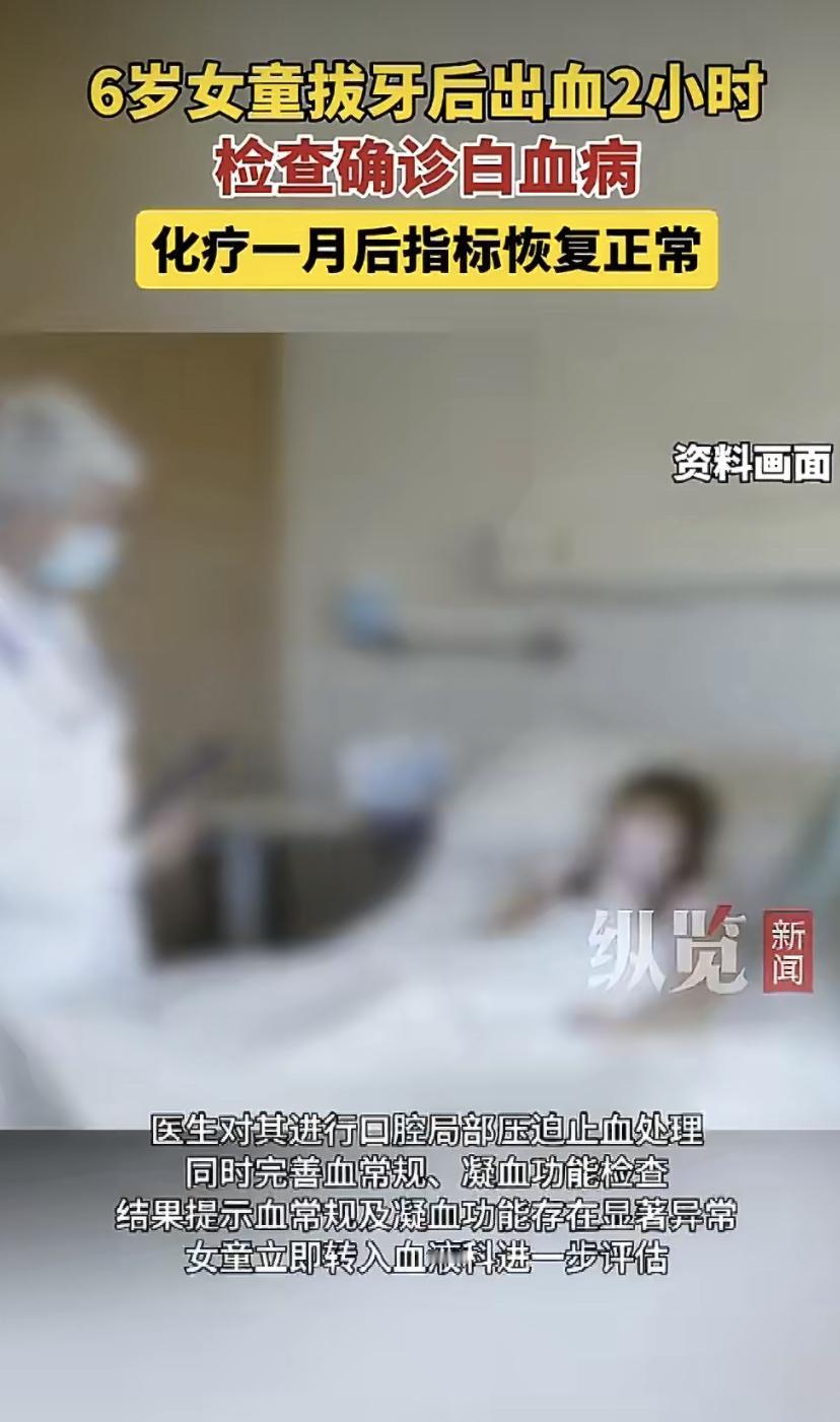 6岁小女孩去杭州一家医院拔个牙，结果血流了两个小时都止不住!
医生赶紧止血，一查