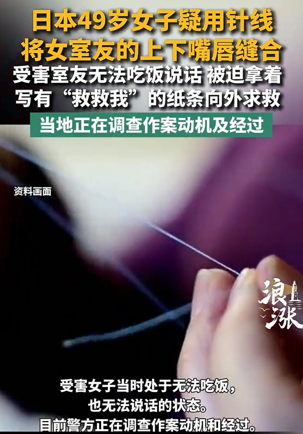 太残忍了！小日子的变态人真是多呀！小日子一女子居然用针线把室友的嘴唇给缝上了，不