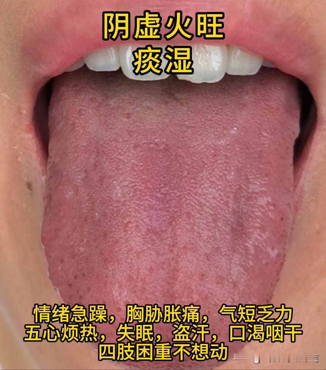 下午有空，可以帮大家看看舌象。
有需要的，尽管把你的舌象照片发过来吧！越早发，我