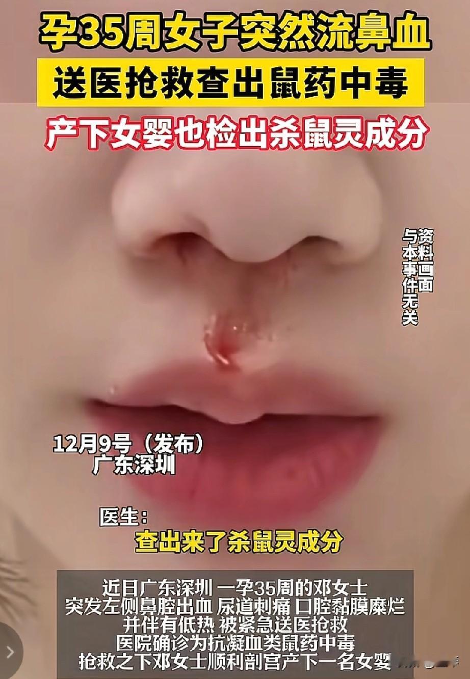 35周孕妇血液查出耗子药，谁在给孕妇和胎儿下毒？


 
广东深圳一名怀孕35周