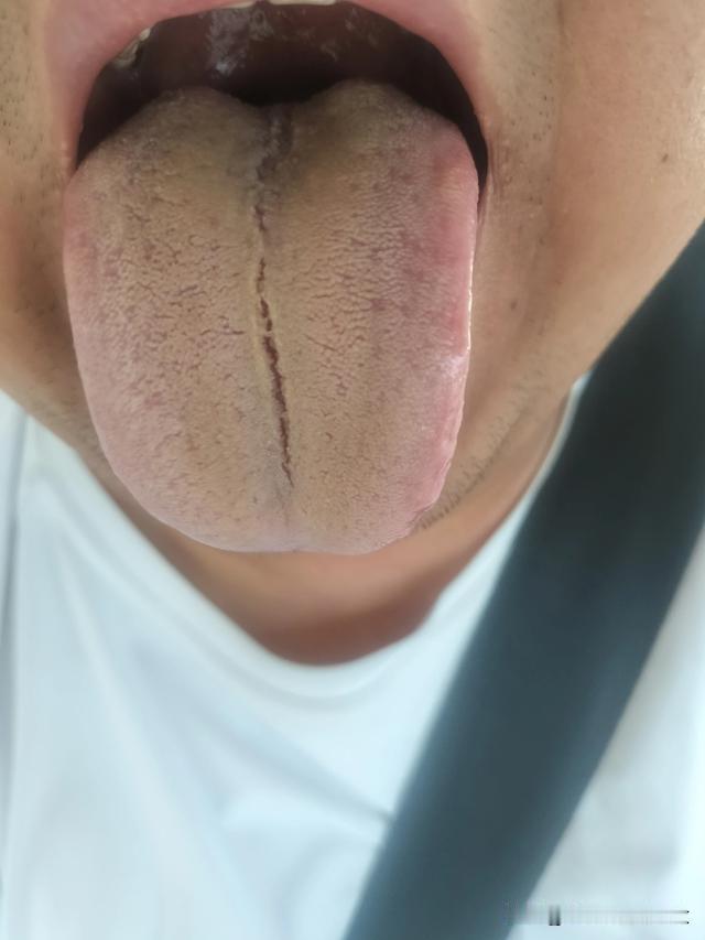 就这舌头，你还补肾，补血，你补啥都不好使[狗头][狗头][狗头]
你看看你那舌头