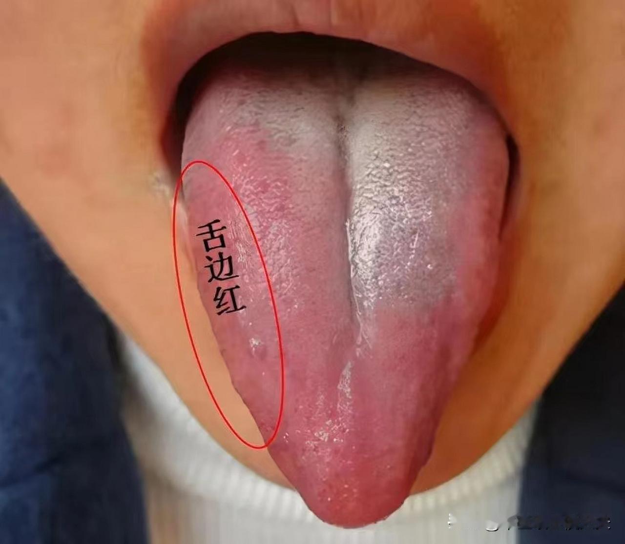 男同志注意了，同样是泄精，用手可比房事危害大的多！

患者主诉：年轻时不懂事，每