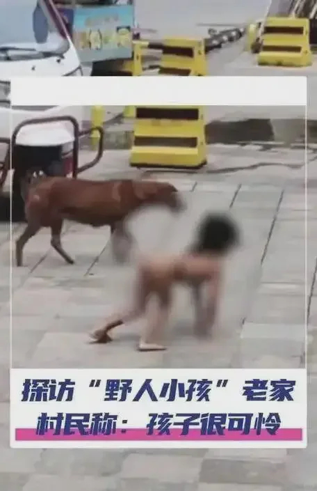 野人孩子已出现动物化特征这两天刷到新闻 感觉很难受😣“人为犬化”这个词  真的