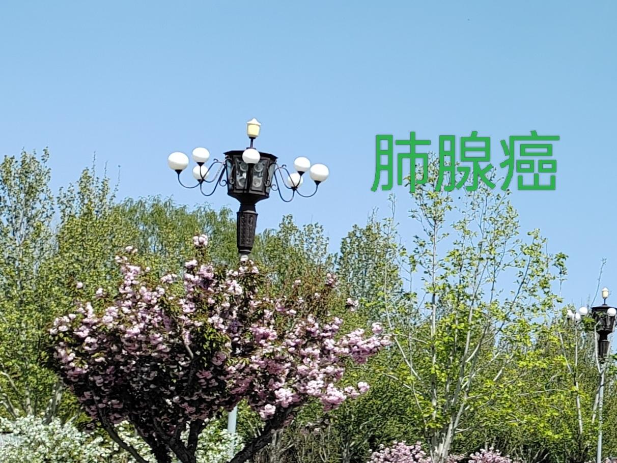 肺腺癌的症状有什么?
经常感冒，流清鼻涕。
旅游，别想了，只随时就感冒这一点，哪