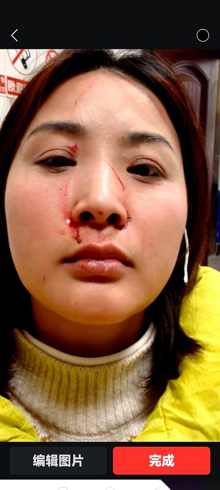 结婚第25年，让刘女士认清枕边人的，不是什么深奥的道理，而是一个实打实的耳光。
