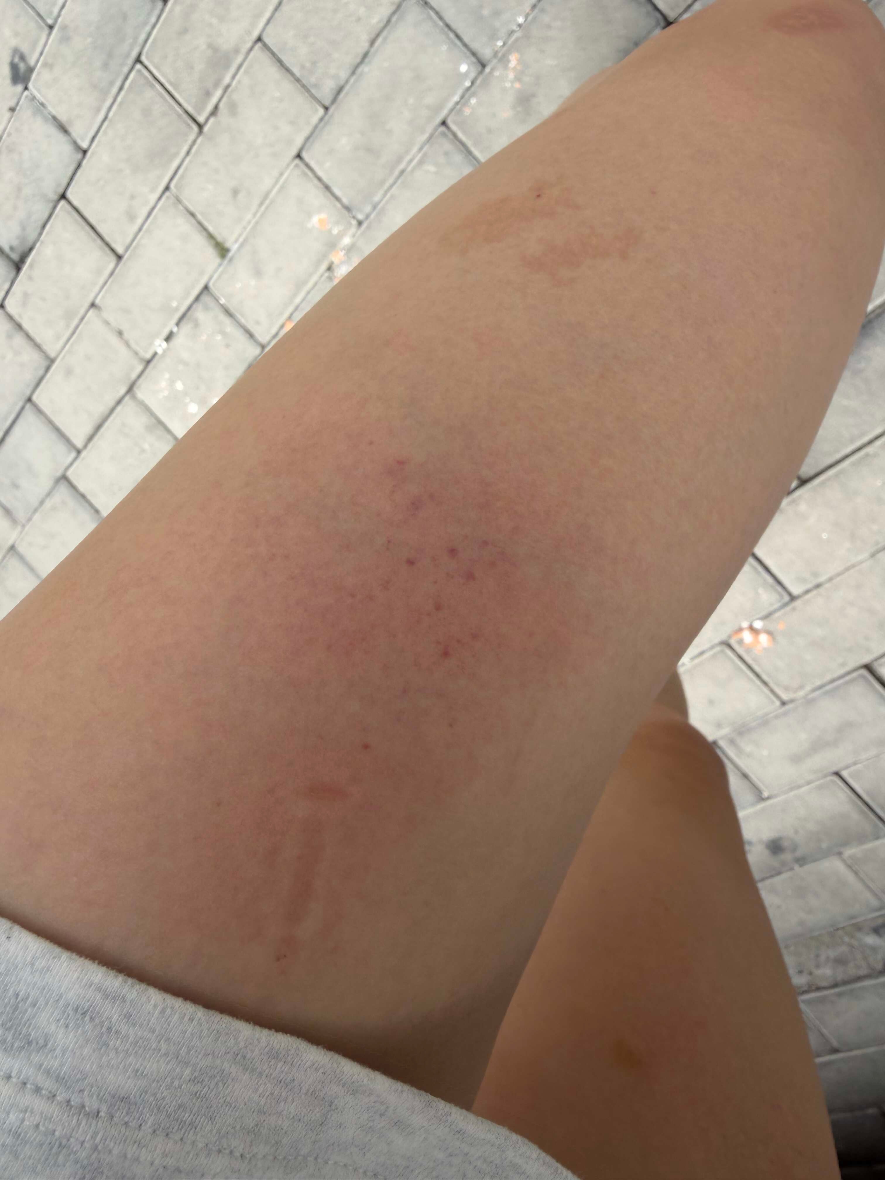不拍照等于没练💅山羊挺身给我腿杠淤血了  ​​​