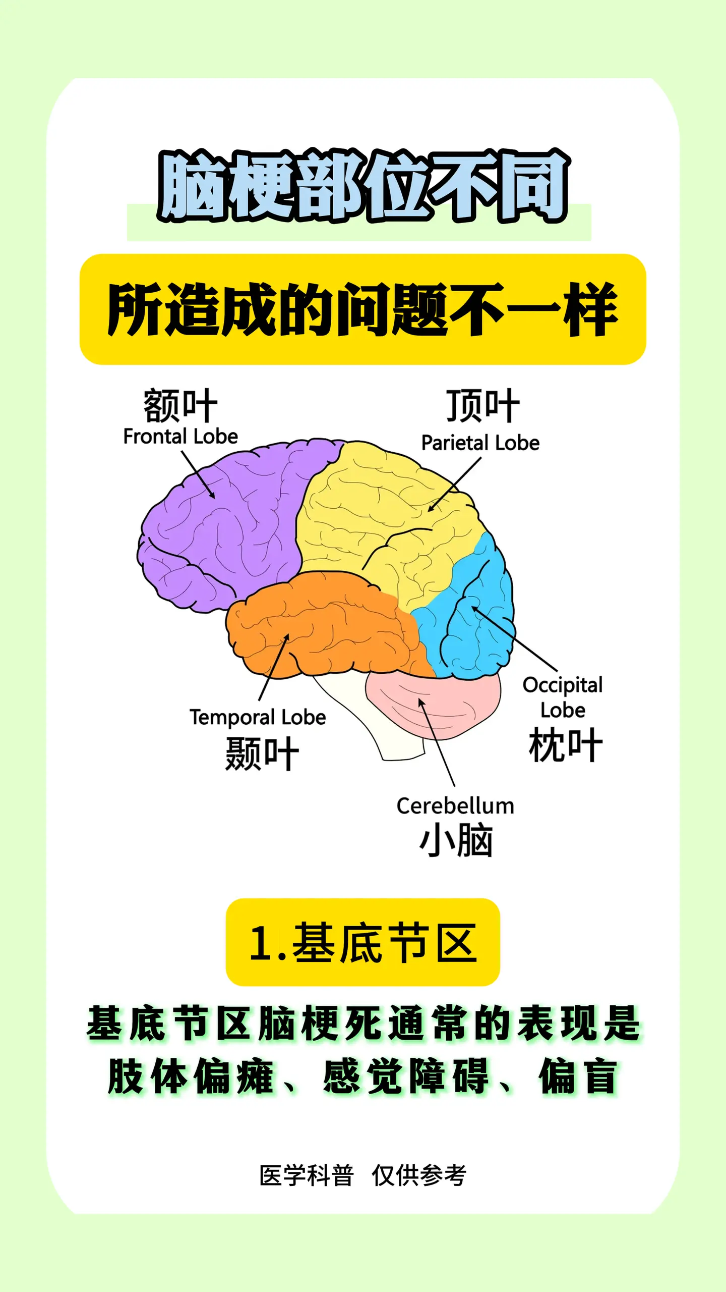 脑梗的部位不同，所造成的问题也不同。