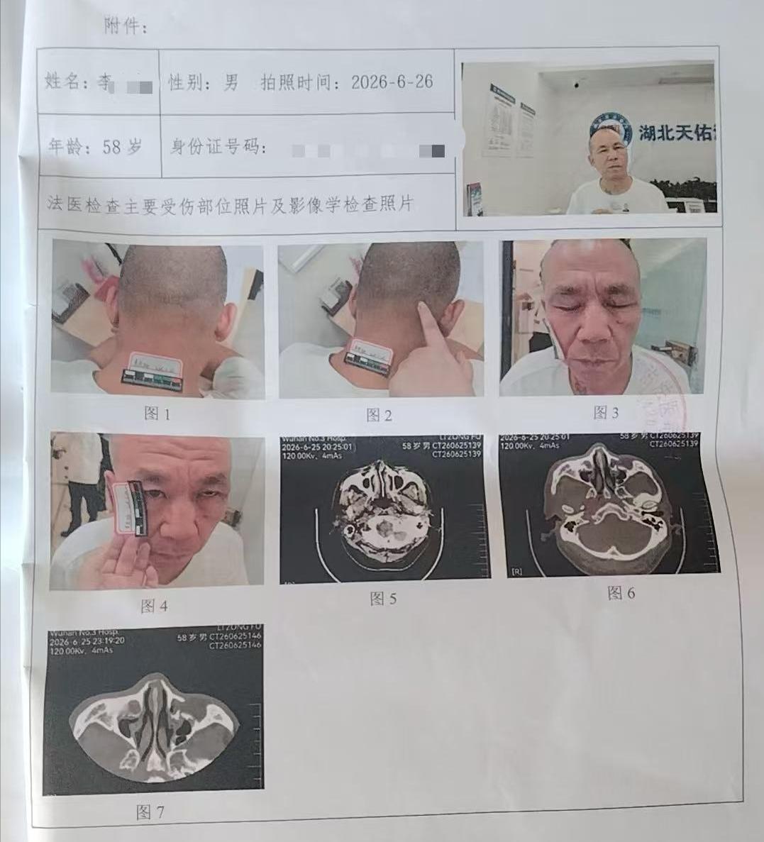 “这效率有点低！”湖北荆门，58岁男子因劝邻桌的人说话不要太大声，结果遭到对方3