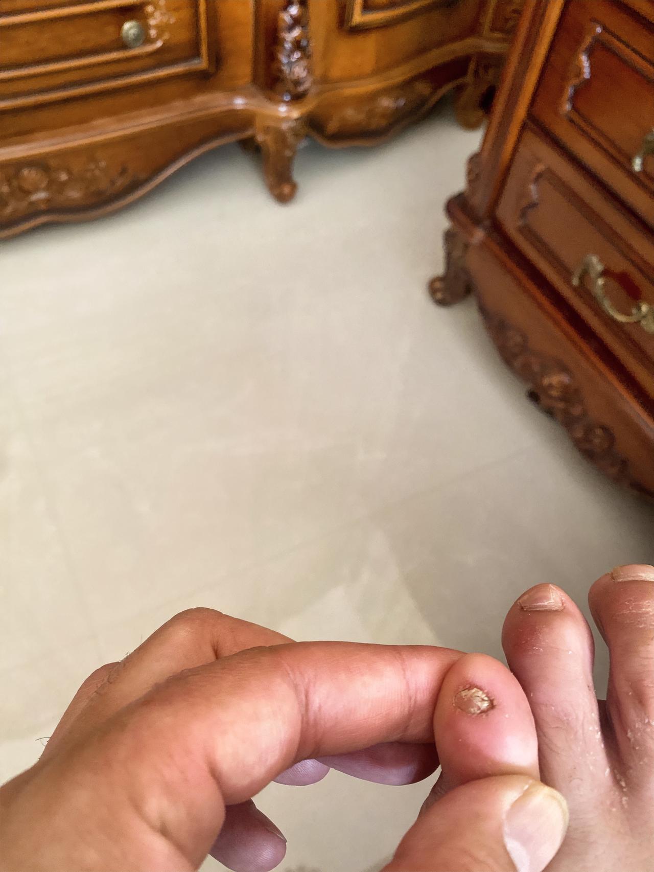 谁的祖先，脚丫子小拇指没有指甲，有的报数