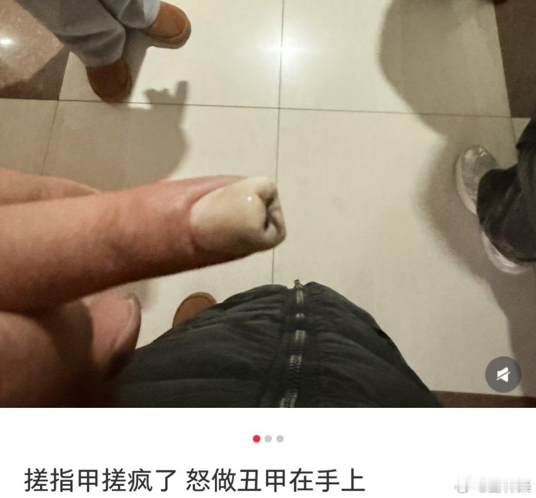 看得我眼前一黑[衰]看了挺多丑甲案例，我宣布你是冠军 