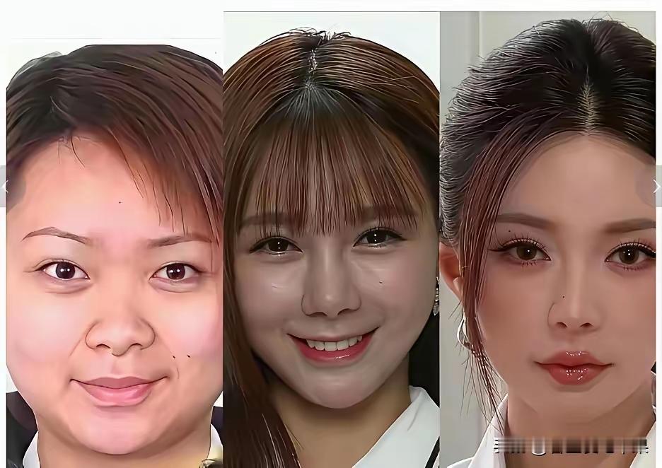 沈梦辰是典型的越长越漂亮，以前又胖，五官粗糙，后来的她越长越精致完美。