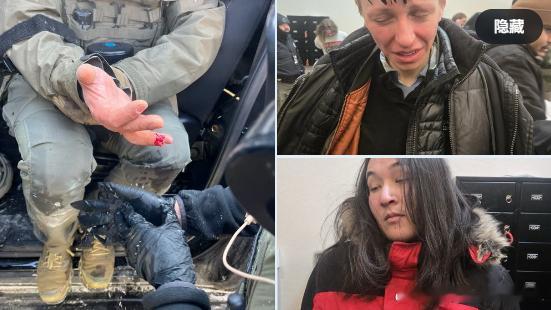 【黄金时代】刚刚，左翼暴徒在明尼阿波利斯咬掉了一名国土安全调查局（HSI）警官的