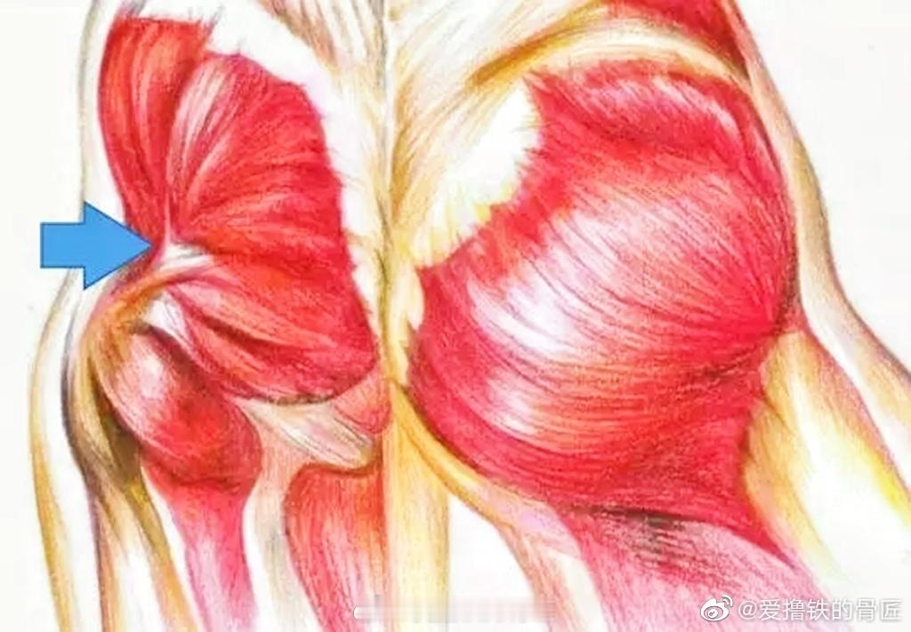 PP问题很多是骨科问题，所以有时候对一个人印象深刻，是因为PP…之前有个大四女学