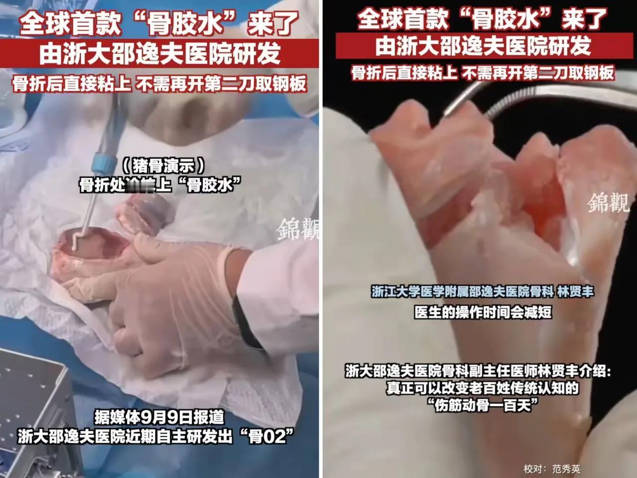 这下出名了，
不仅中国，连全世界都要知道了。
万万没想到，浙江邵逸夫医院研发出了