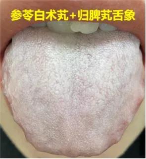 常吃参苓白术丸，脾胃强健，气血充盈，痰湿减少，气机顺畅，肾脏也强健！中医来教你如