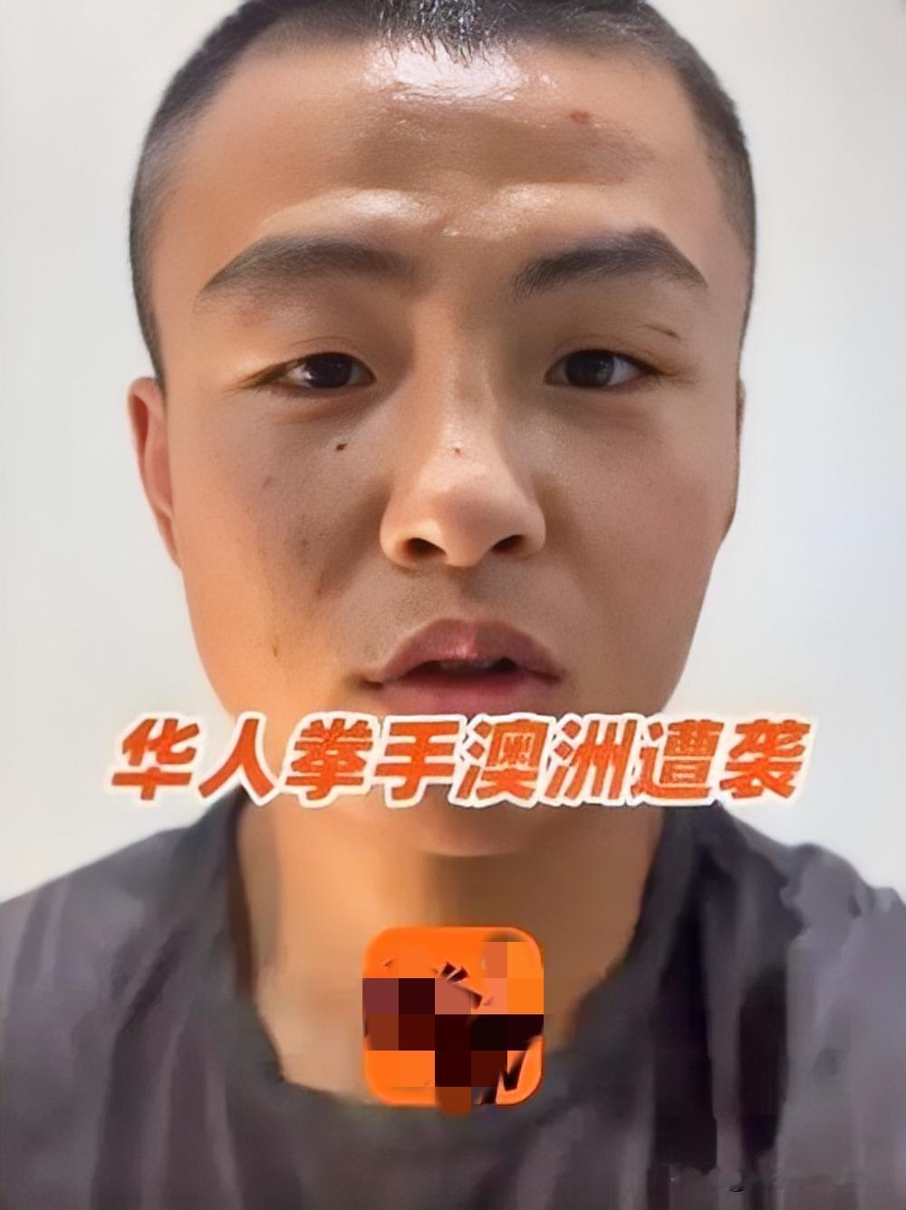 中国拳击手澳公交遇袭，锥子扎头险丧命

2025年10月14日，中国职业拳击手周