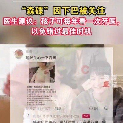 医生称森碟下巴后缩或影响口腔功能 森碟 因下吧被关注，医生建议：孩子可每年看一次