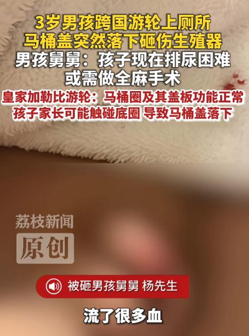 "防不胜防！"3岁男孩在游轮上厕所时，马桶盖突然落下来，砸中了男孩的生殖器，他的