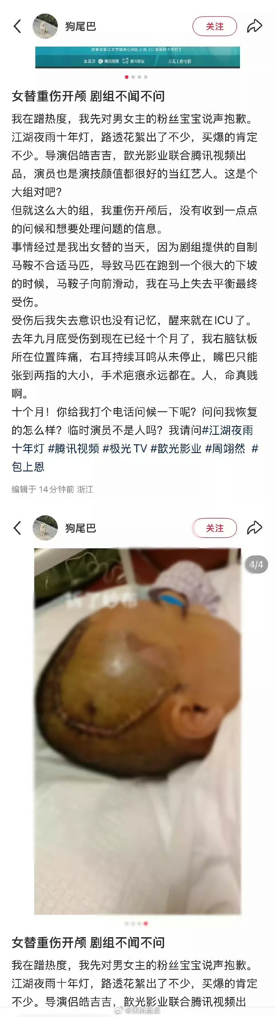 江湖夜雨十年灯女替重伤维权。。。omg很严重了 ​​​江湖夜雨十年灯剧组女替发文