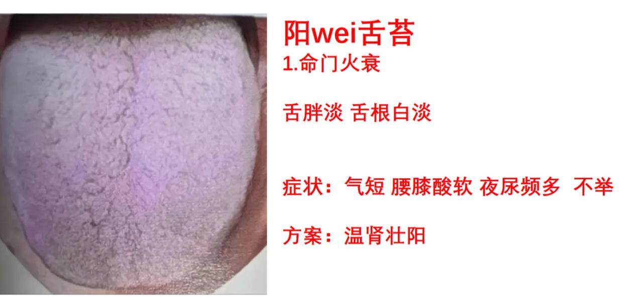 男士状态不佳？对照看看你的舌象属于哪一种证型