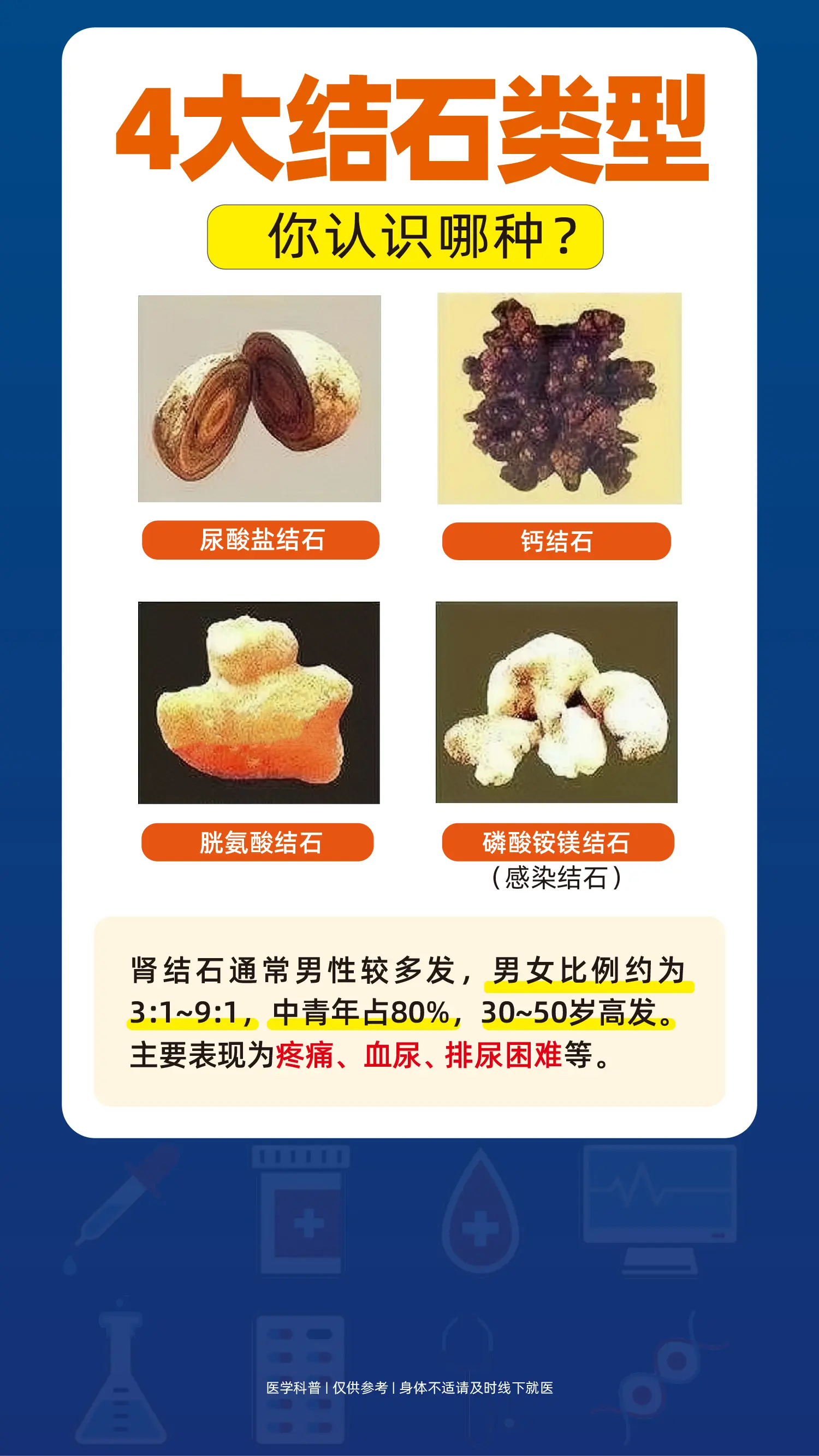 4大结石类型。