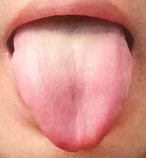 阳气充足则体魄强健，男性固本培元，重在温养阳气






很多伤精多年的朋友都